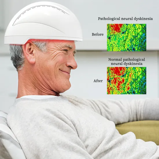 Suyzeko 神経刺激ヘルメット赤外線光治療機光生体調節療法用